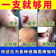 日本丨四国製薬扁平疣专用疣清宁医用退热凝胶可祛去I疣灵型面部去搭除脖子上长的小肉粒疙瘩药去克疣膏LF 1盒装去疣脱落膏【温和祛疣】自用i營用医快速店旗舰