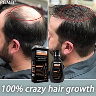 PEIMEI HAIR GROWTH SHAMPOO (250ML) SG SELLER *FAST DELIVERY* ANTI HAIR LOSS &amp; HAIR CARE for All Hair Types EFFECTIVE HAIR LOSS SOLUTION (Ginger shampoo Ginger Anti Hair Loss,Hair Growth Shampoo,FOR SCALP CARE,Anti-Hair Loss,Shampoo For Oily Scalp,HERBAL