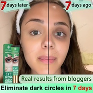 Eliminate dark circles in 7 days eye cream dark circles dark circles eye cream dark circle dark eye 