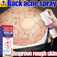 Back acne spray body acne 60ml Japanese anti-acne, acne removal, acne scar removal, back mites remov