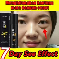 Serum Mata ADMD Cream 20ml Eye Cream Origina Menghilangkan Kantung Mata Dengan Cepat Krim Mata Anti 