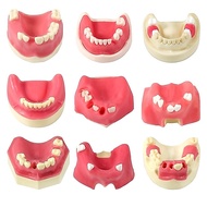 Dental Implant Practice Model Teaching Practice Model