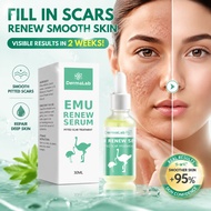 Dermalab Serum Muka 30ml Emu Renew Serum Scar sunken repair, fade spot acne mark moisturizing essenc