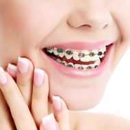 Fake Teeth Braces Kids Fake Braces Colorful Braces Wire Braces Lip Protector Teeth Braces Wire Styli