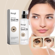 Hoygi Snail Viscopin Serum Hydrate Moisturizing Net Translation Glossy Sense Improves Raw Serum