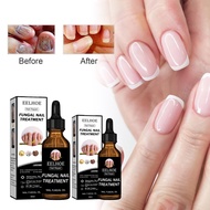 EELHOE Nail Repair Solution Thickening And Brightening Nails Removing Gray Nail Repair Nourishing Na