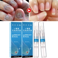 Toenail Fungus Treatment Antibacterial Nail Repair Pen Anti-fungal Treatment