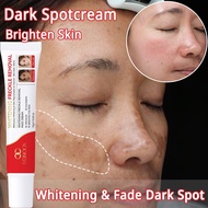 Whitening Freckle Cream Dark Spot Moisturizer | Krim Jeragat | Whitening & Fade Dark Spot Brighten S