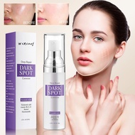 50ml Dark Spot Remover for Face and Body, Dark Spot Corrector Cream, Skin Brown Spot Remover, Age Sp