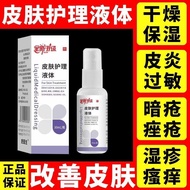 Spray Convenient Yaguoning Skin Eczema Anti-itch Spray Skin Liquid Dressing Concentrated Eczema Gel 