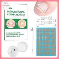STHB 1/2 Set Ingrown Toenail Corrector Tools Pedicure Recover Embed Toenail Treatment Professional F