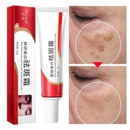 Whitening & Freckle Remover Cream  remove dark spots on face melasma and pekas remover original dark