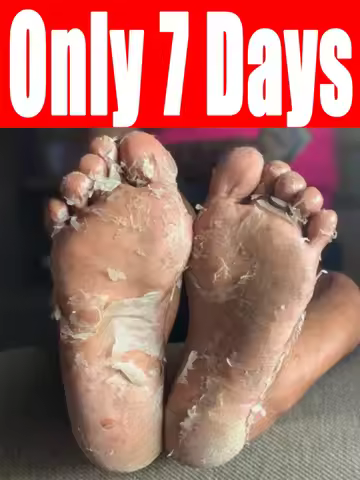 Moisturizing Foot Exfoliant Spray nourishes ᴅʀʏ ғᴇᴇᴛ ʀᴇᴍᴏᴠᴇs ᴅᴇᴀᴅ sᴋɪɴ ᴀɴᴅ sᴍᴏᴏᴛʜs ᴄʀᴀᴄᴋs.