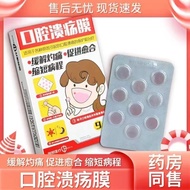 Chuangbang Medical Oral Ulcer Patch Oral Ulcer Film Children's Oral Patch Oral Ulcer Film 25.9.12