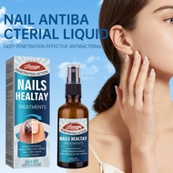 Lunon antifungal polish spray liquid kamay, paa at pako