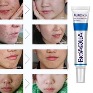 BIOAQUA Removal Acne Scar Treatment Cream