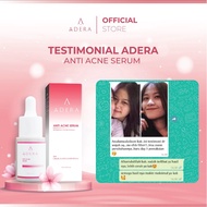 BOOM SALE Serum Wajah Adera Anti Acne Skincare Bebas Jerawat BPOM
