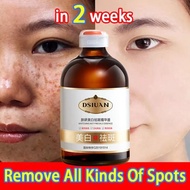 Whitening Essence Serum Remove Freckle Fade Dark Spot Anti-aging Whiten Facial Moisturize Serum / Se