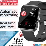 Smart Watch Non Invasive Blood Glucose 1.72'' PPG+ECG BP Body Temperature Monitoring Waterproof Sports Elderly Health Watches