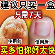 茅仁堂云南本草灰指甲液生长液生甲液灰甲液脚趾增厚软甲脱甲膏多买多送非特I效中草成分重度清 一盒装【轻度装】推荐多盒装