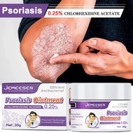 Jemeesen Eczema Cream Psoriasis Ointment Chinese Herbal Antifungal Cream Antibacterial, Antiviral, R