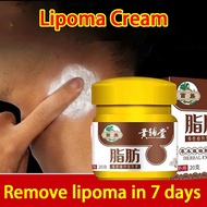 Lipoma Removal Cream Original Removing Lipoma lumps bulge diminish inflammation Lipoma Lipolysis Rel