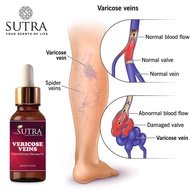 Sutra Vericose Veins Massage Oil 30ml - Minyak Urat Simpul | Kebas | Simpul Biawak