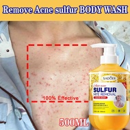 Sulfur shower gel anti acne sulfur mite removal shower gel anti mite itching antibacterial oil contr