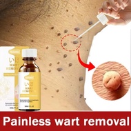 Painless wart removal ubat ketuat kutil remover wart remover mole remover cream ubat ketuat tapak ka