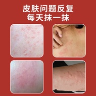Itch King Hong Kong Kowloon Pharmacy Itch-Relieving Cream 30g Whole Body Can Soothe Skin Discomfort 
