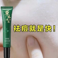【拾光优品文具kongshi342.my】 现货！草本祛痘膏祛痘印美白痘坑粉刺痘疤黑头祛斑面霜护肤修护学生男女Herbal acne cream for removing acne marks, wh