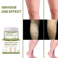 Eelhoe cream varicose