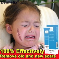 Original ultra Scar Gel 20g，Dermatic Acne Scar Reduction Cream Advance Gel Scar Formula,surgical sca