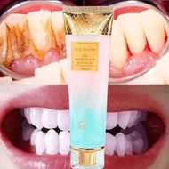 TOOTHPASTE TEETH WHITENING REMOVER TARTAR Ubat gigi pembersih gigi Menghilangkan karang gigi Menghil