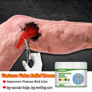 Varicose Veins Relief Cream Varicose Removal Essence Cream For Men Ointment Varicose Veins Body Enha