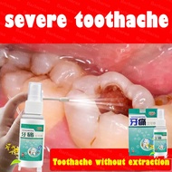 ✨Safe to eat✨35ml Toothache Spray35ml Toothache quick pain relief spray quick-acting toothache toothache pain relief gum swelling and pain tooth decay gum allergy insect tooth toothache anti-pain spray