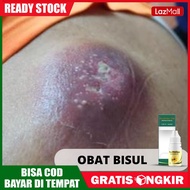 ProPolis Asli - Obat Bisul Bisul di pantat Bisul Bernanah Bisul Berdarah Pengempes Bisul Bisul Kodok