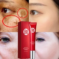 Effective Melasma Freckle Remover Cream 20g Collagen Pekas Remover Original Dark Spot Remover