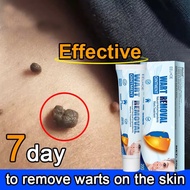 【EELHOE】 Warts Remover Original Cream Wart Remover Ointment Wart Treatment Skin Mark Remover Cream Antibacterial Foot Wart Ointment Face Body Care (20G)