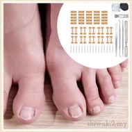 [ShiwakibcMY] Ingrown Toenail Correction Kit Breathable Ingrown Nail Correction Patch