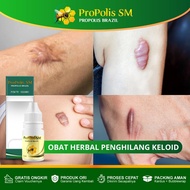 PROPOLIS SM - Obat Herbal Keloid - Penghilang Keloid - Bekas Luka Menahun - Daging Jadi - Daging Tum