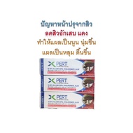 SCAR X-PERT CREAM 10 กรัม ครีมทาแผลเป็น รอยนูน เพิ่มสาร hyaluronic เข้มข้น ช่วยลดริ้วริย แผลหลุม หลุมสิวของแท้100%