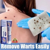 Warts remover original Mole remover Skin tag remover Removal freckle and melanin spots