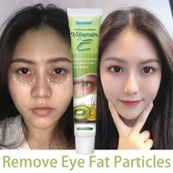 Fat Granule Cream Vitamin E Milia Seed Remover Eye Cream Syringoma Milia Remover Grease Grains