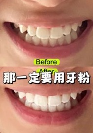 【清貨特價多買多送】Cici 美白牙齒🦷系列 美白 藍光美白 美白牙齒 口腔護理 牙粉 牙膏 牙刷  牙黃 牙血 牙肉腫痛 牙周病 蛀牙 牙石 美白 吸煙 咖啡漬 咖啡