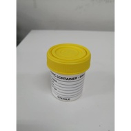 URINE CONTAINER WITH YELLOW CUP 60ML (PLASTIC)