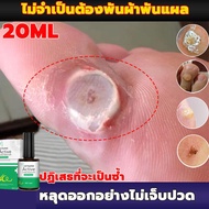 【ทดลองใช้ฟรี 7 วัน】จัดส่งสินค้าในกรุงเทพฯ ลบ(หูดที่เท้า ตาปลา หูดเส้น หูด แหลม ชิ้นเนื้อ ตาปลาที่เท้