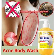 Sulfur shower gel, acne removal, whitening, antibacterial, deep cleaning, moisturizing, itching show