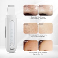 CkeyiN Facial Skin Ultrasonic Scrubber EMS Ion Face Cleanser Blackhead Remover Pores