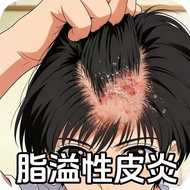 Ready stock Scalp Redness Itchy Scalp Cum Scalp Dandruff Fatty Dermatitis Head Hair Follicles Yan Sc